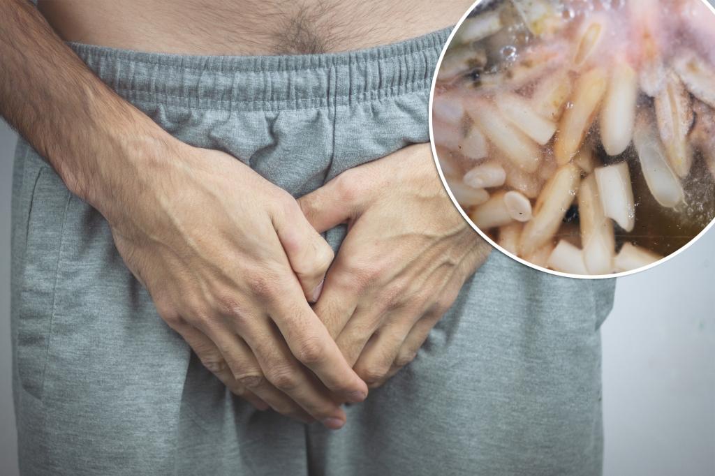 Man suffers from strange penile infection after dinner and 'powerful' sex - here's how