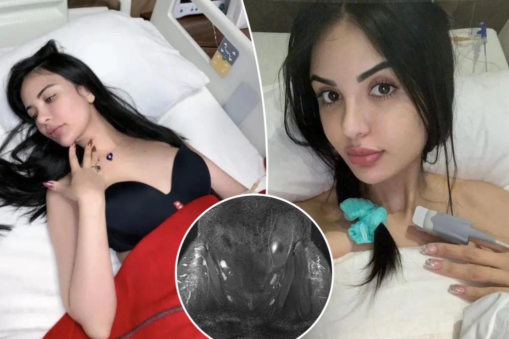 'Surgery addict' who spent $1 million to look like Kim K says buttock filler left her infertile, in constant agony: 'My limitations are severe'